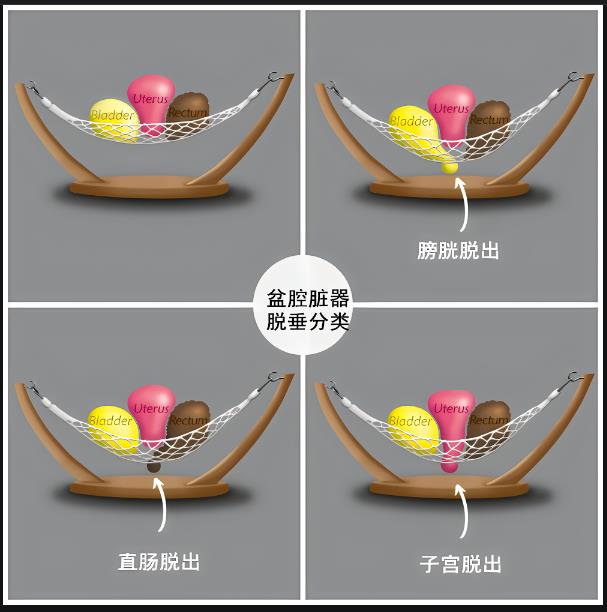 图片2 图片2.png