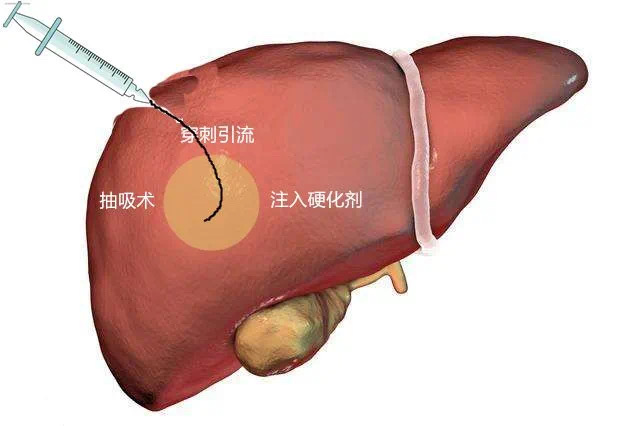 图片2 图片2.png
